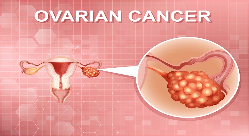 World Ovarian Cancer Day - Gynecologic Oncology and breast cancer specialist in Lucknow